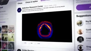 Twitter page with brain scan image — Screened Out